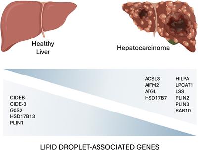Exploring the impact of lipid droplets on the evolution and progress of hepatocarcinoma